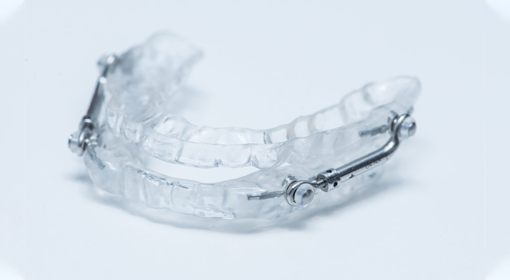 dispositivo-avance-mandibular Dispositivo de avance mandibular