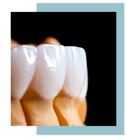 estetica-dental-en-torremolinos Tratamientos de estética dental en Torremolinos