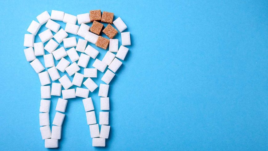 Los empastes dentales como solución a la caries