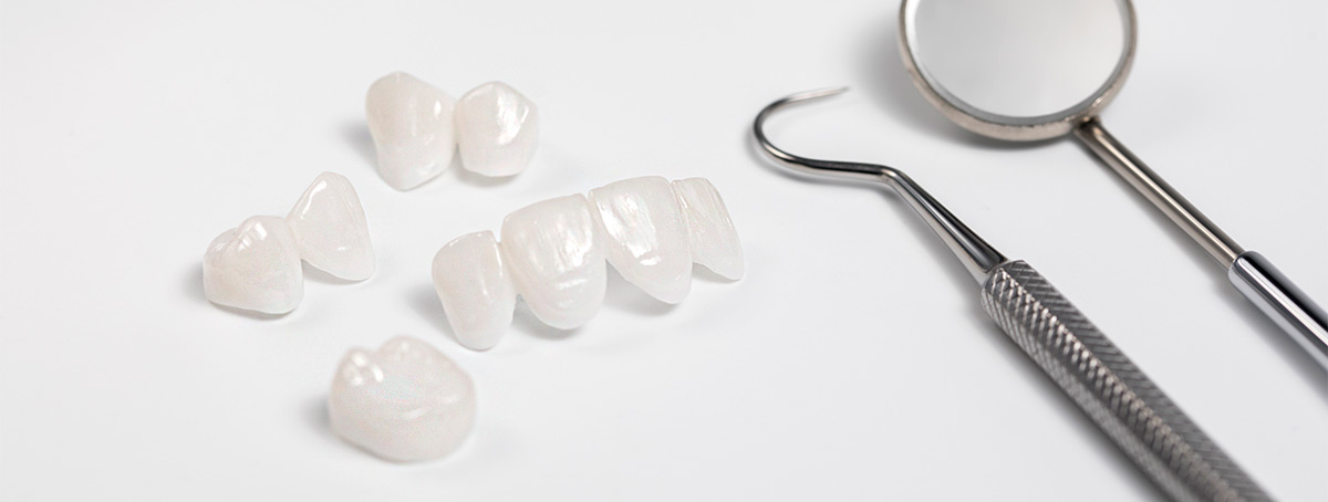 Cómo cambiar la forma de tus dientes en Torremolinos