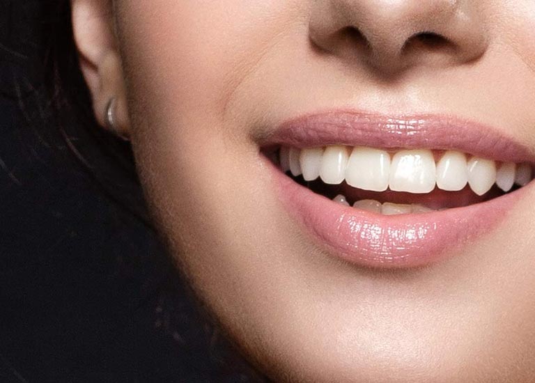 clinica-dental-torremolinos-malaga