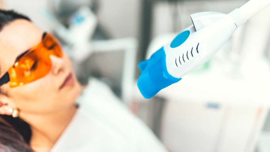 ¿Voy a tener sensibilidad dental si me hago un blanqueamiento?