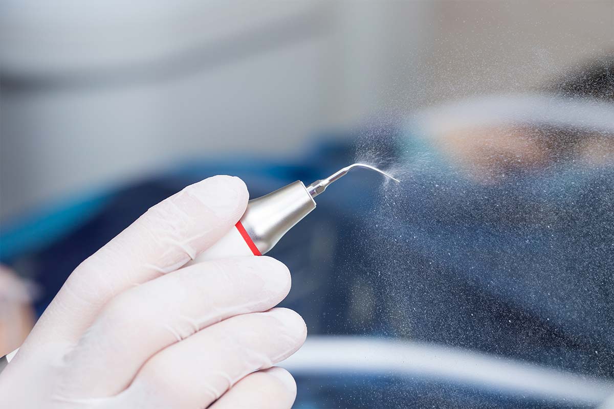 Tratamientos complementarios implantes dentales Tratamientos complementarios implantes dentales