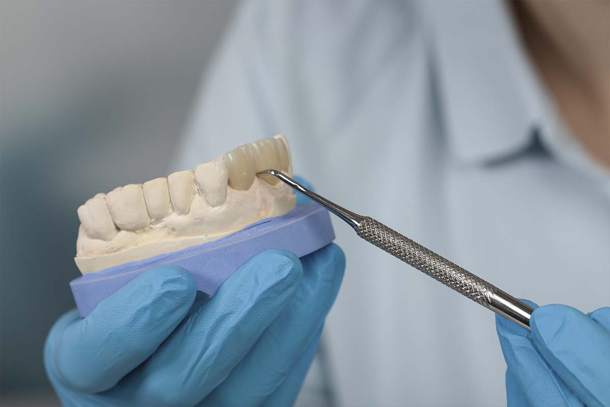 Prótesis dentales Prótesis dentales