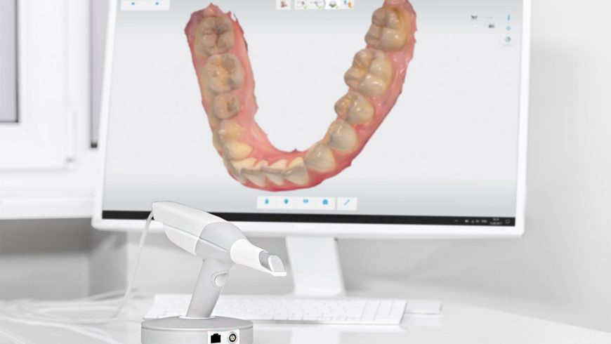 Incorporamos en nuestra clínica el escáner intraoral TRIOS