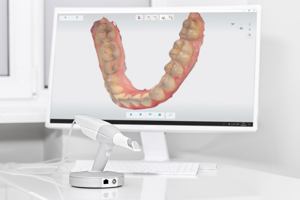 Incorporamos en nuestra clínica el escáner intraoral TRIOS