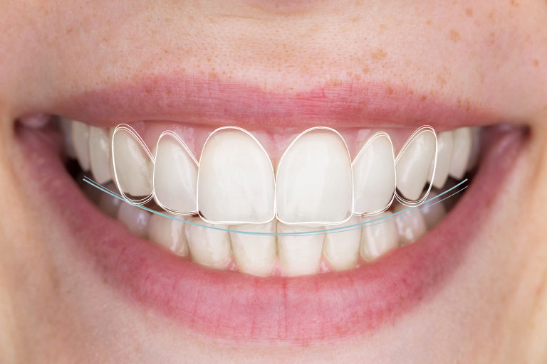 diseño digital de sonrisa de mujer