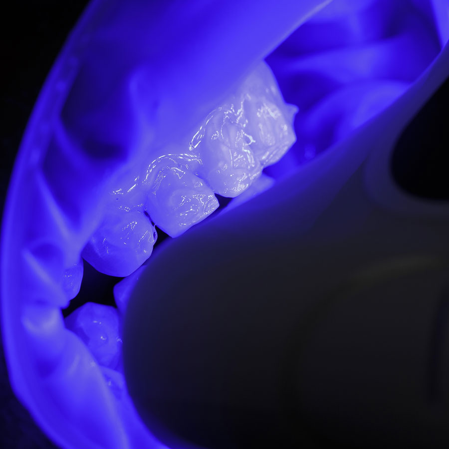 blanqueamiento dental luz led en clínica