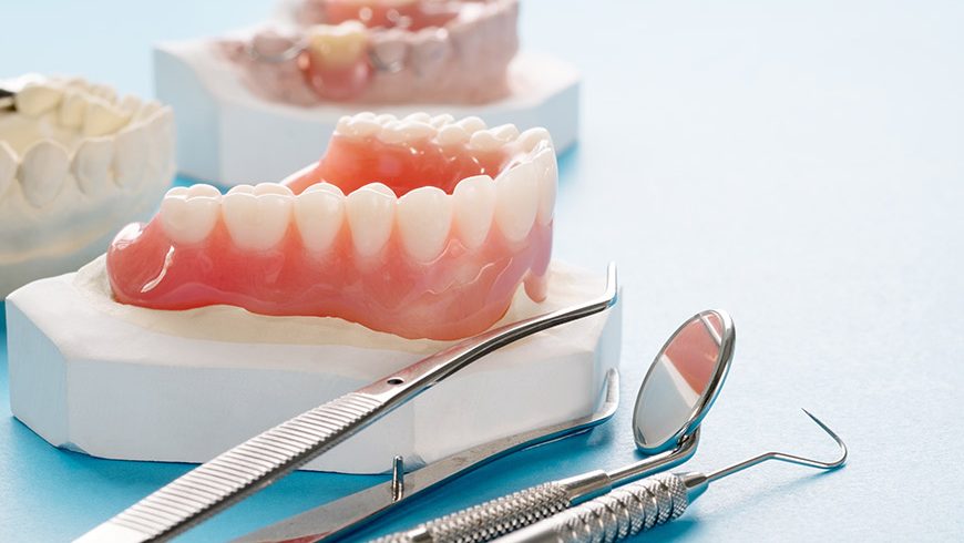 Prótesis dental fija Vs. Prótesis dental removible