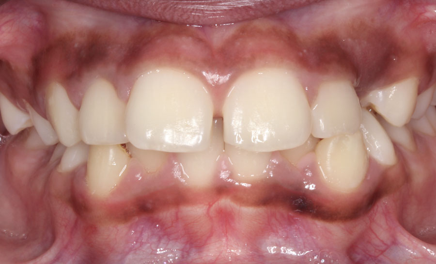 Before image