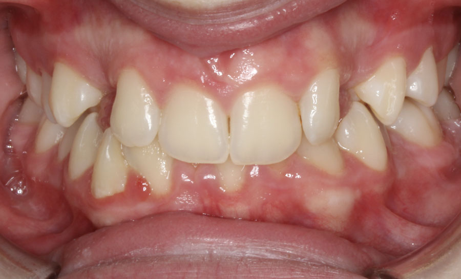Before image