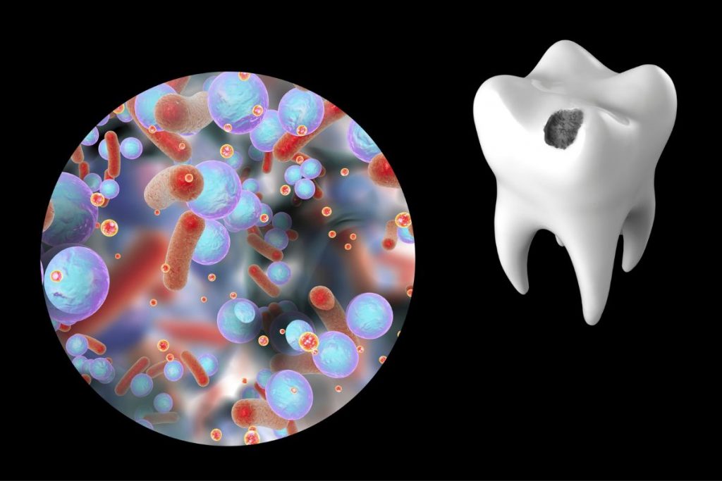 Factores de riesgos en las caries.