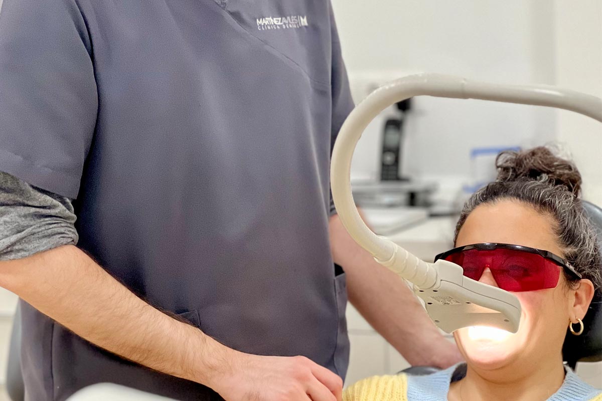Blanqueamiento dental en Torremolinos, el tratamiento estrella en estética dental.