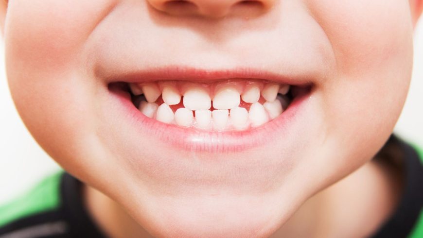 7 consejos dentales para empezar con buen pie el colegio.