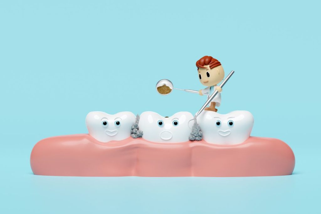 Caries en dientes de leche.