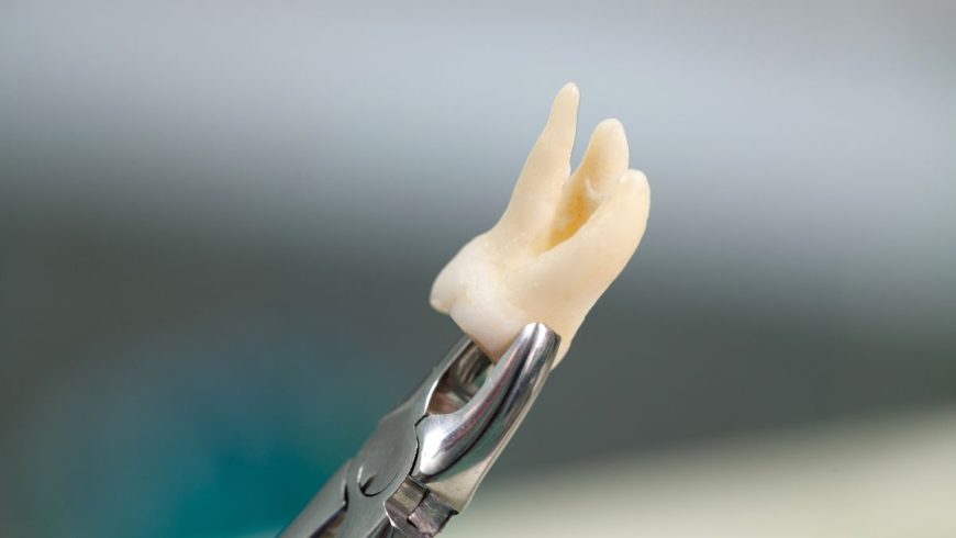 Instrumental básico en tu clínica dental de confianza.