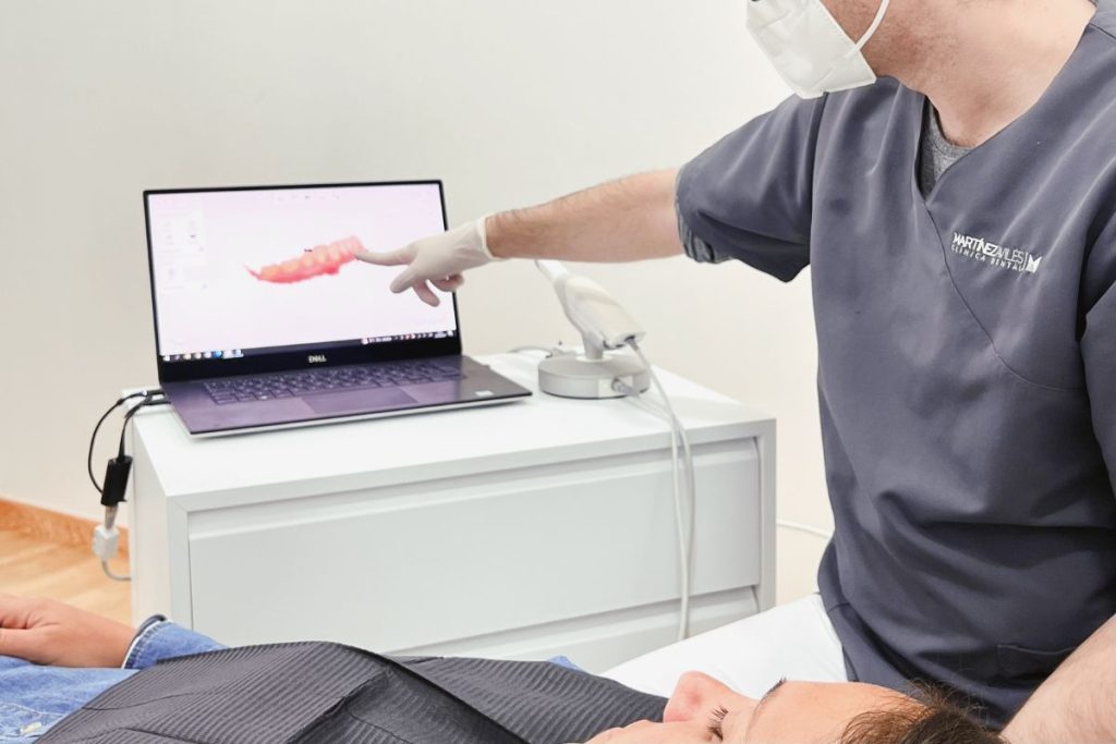 Ejemplo real con paciente en el uso del escaner intraoral en Torremolinos.
