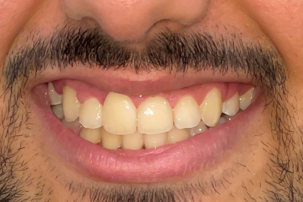 Imagen completa del paciente post tratamiento dental.
